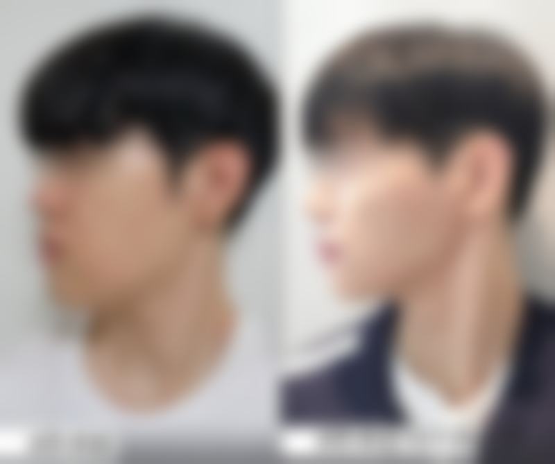 成都天府新区可纳儿医疗美容门诊部顾客实例