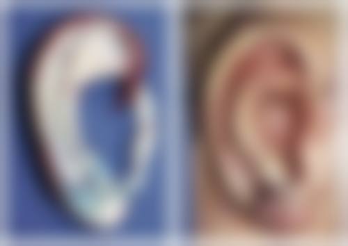 埋线双眼皮以后取线吗？取线时机、修复方案及恢复周期全解析
