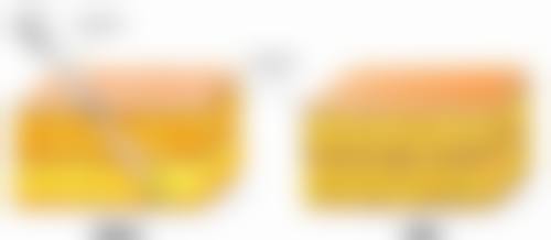 埋线双眼皮以后取线吗——北京米兰柏羽丽都
