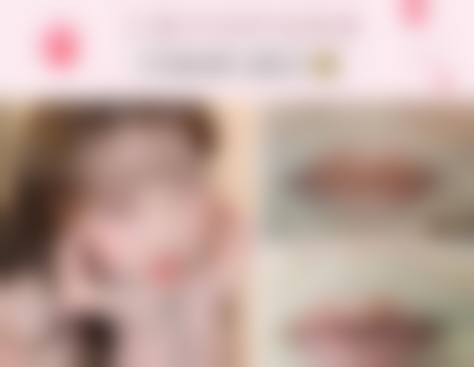 潍坊善绣和美整形医院口碑评价
