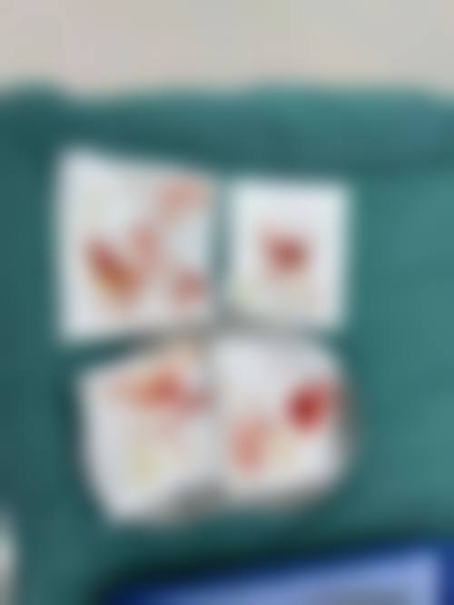 韩勋医生做手术价格