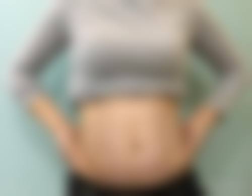 七、韩国raffine艾菲妮整形医院口碑好不好?附真实患者口碑评价