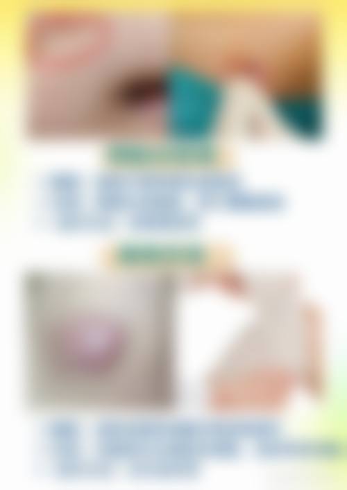 怎么去除黑的疤痕——石家庄蓝山