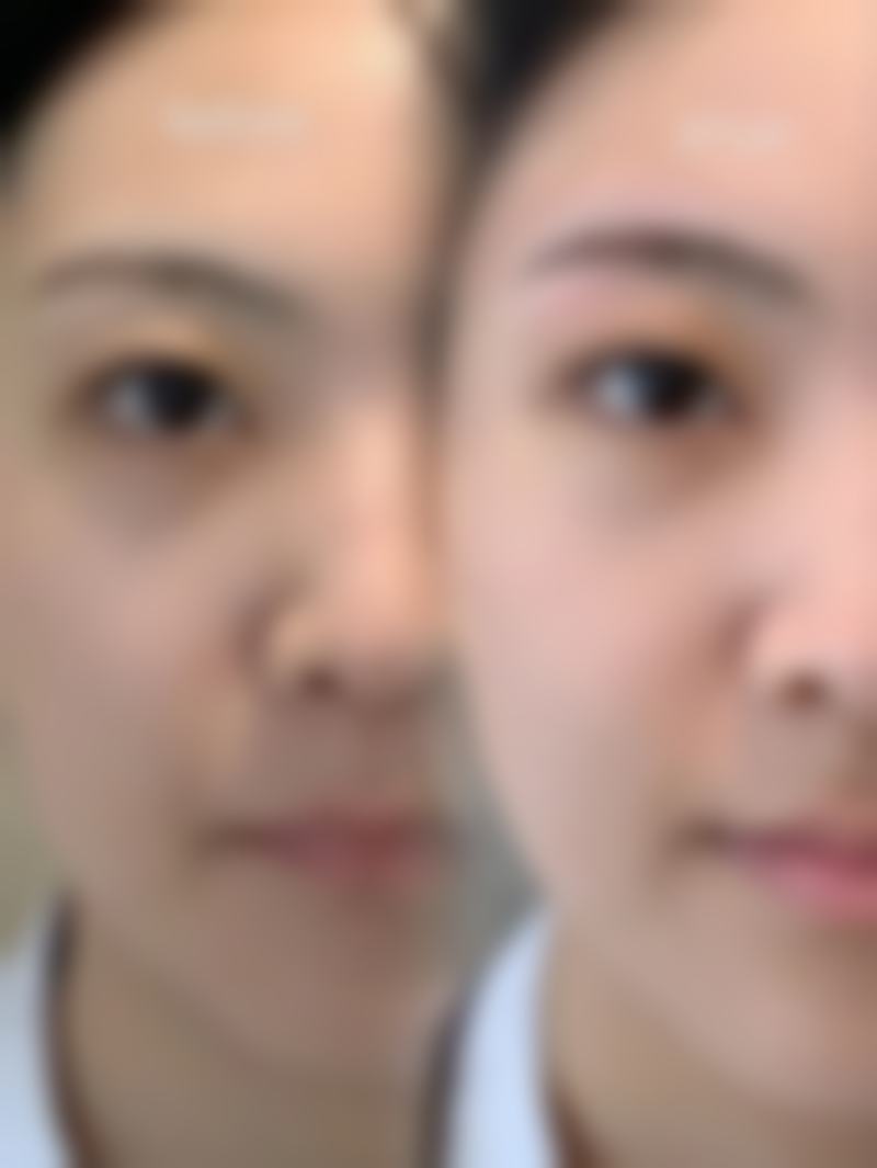 广汉滤镜时刻整形医院项目特色