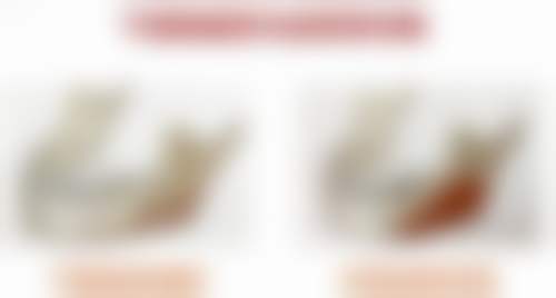 南京心追欧微医疗美容诊所更擅长什么