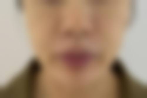 上海安奈美医疗美容诊所怎么挂号，地址在哪儿