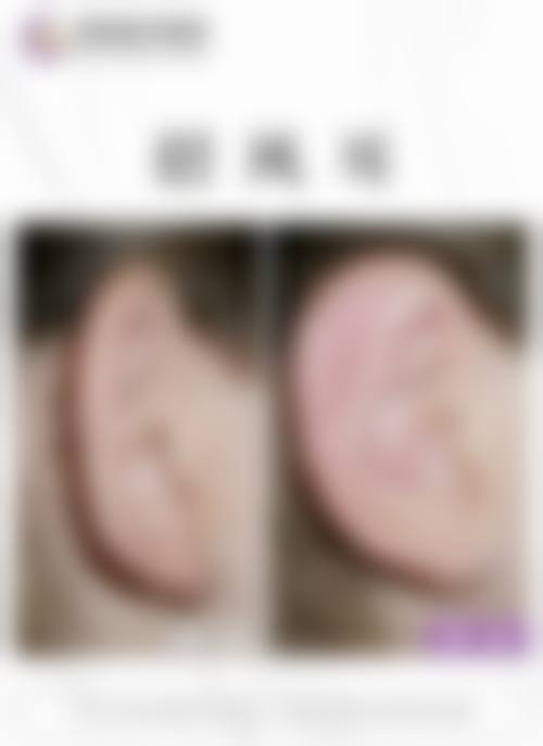 预约优惠活动