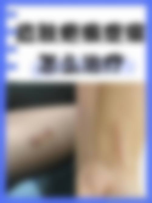 中医怎么治疗疤痕疙瘩——深圳安美聚光医疗美容门诊部