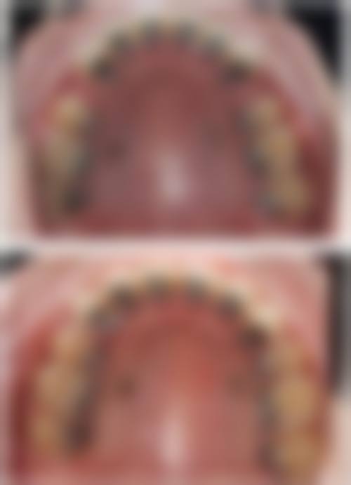 患者常见问题解答(FAQ)