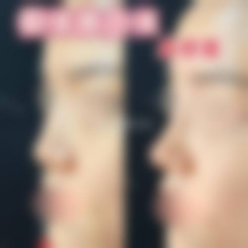 临床实例分享