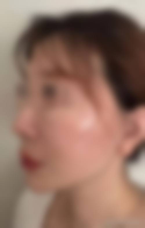 谯颖丹医生顾客实例图片