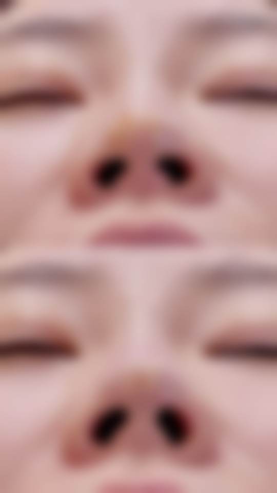 韩国jionu皮肤科