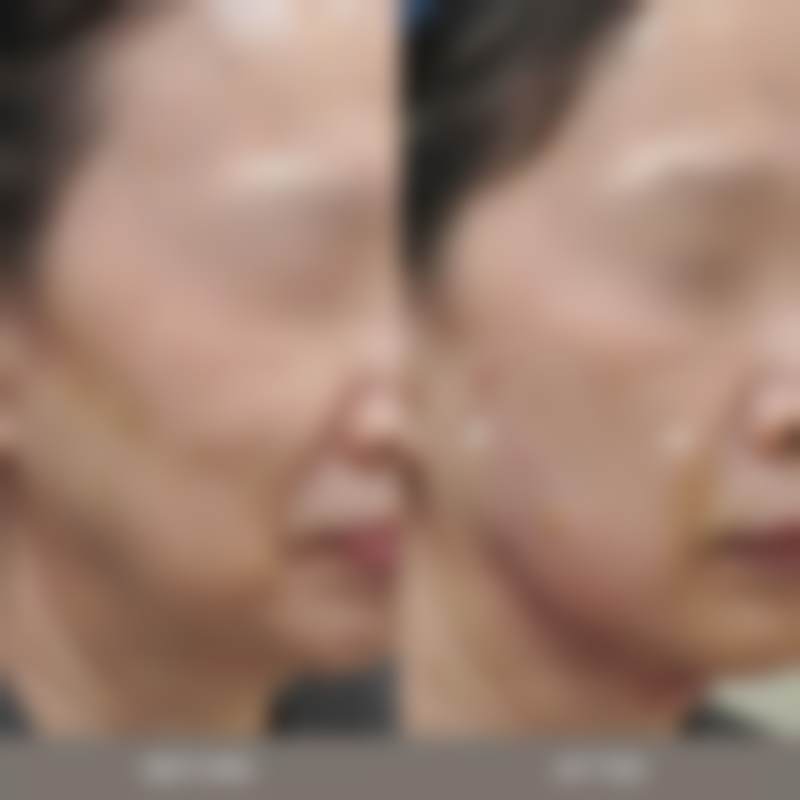 韩国jionu皮肤科