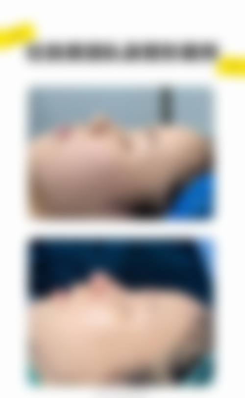 隆鼻碰到了会怎么样——北京圣嘉荣医疗美容医院