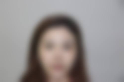 隆鼻碰到了会怎么样——成都华美