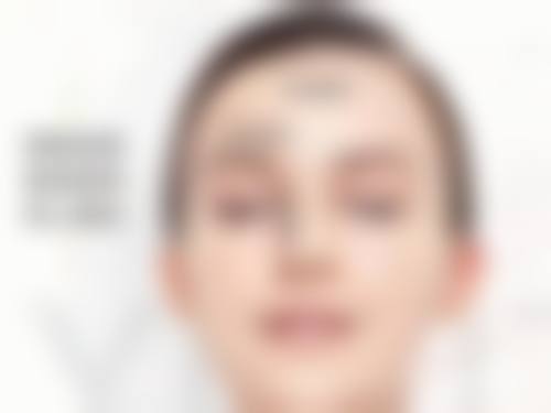 眼袋手术两侧不对称能修复吗——国内医学科学 院整形外科医院