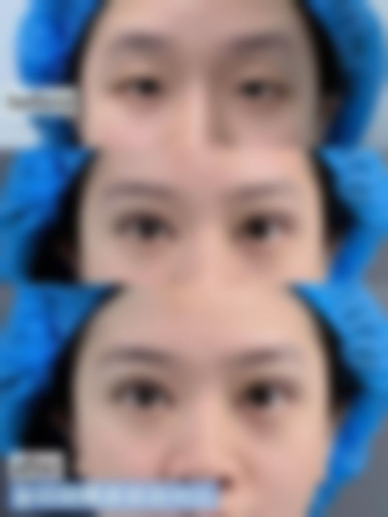 王广为医生做手术价格