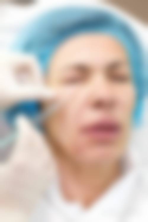 一次除皱针能维持多久——山东省立医院