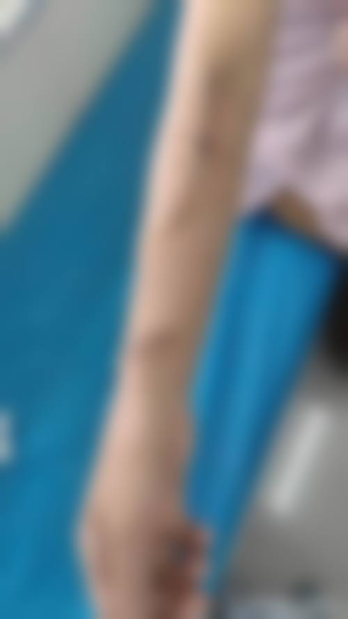 深圳瑞芯整形医院价格表
