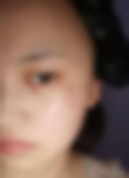 设备环境介绍:保护手术与治疗安心