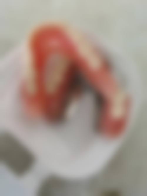临床实例分享