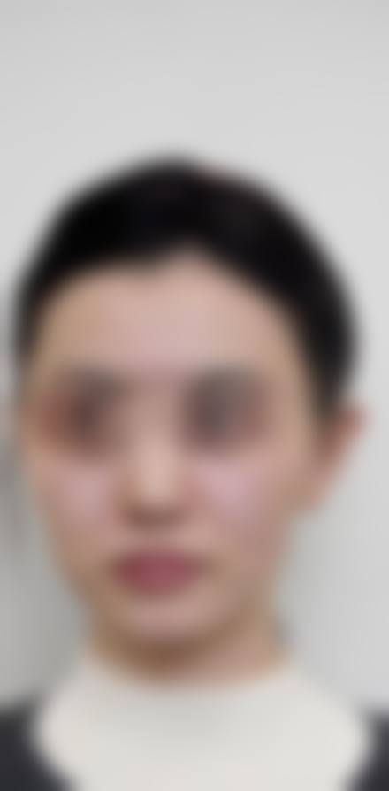 临床实例分享