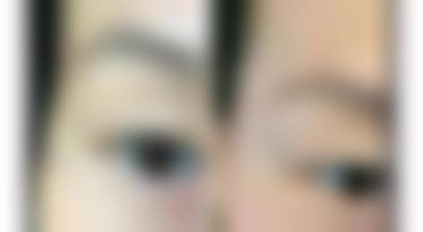 临床实例分享