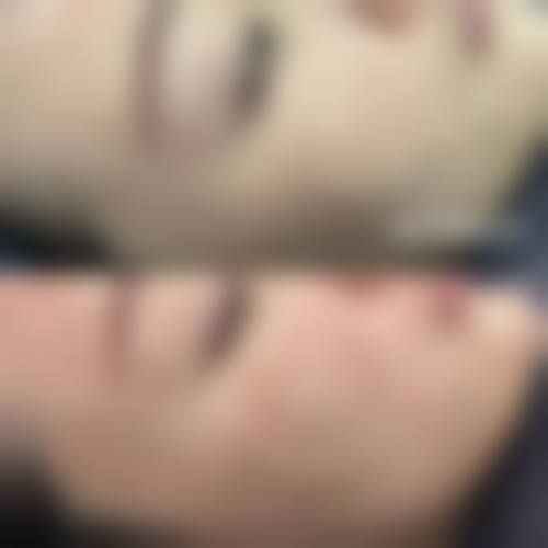 杨凡医生做手术价格