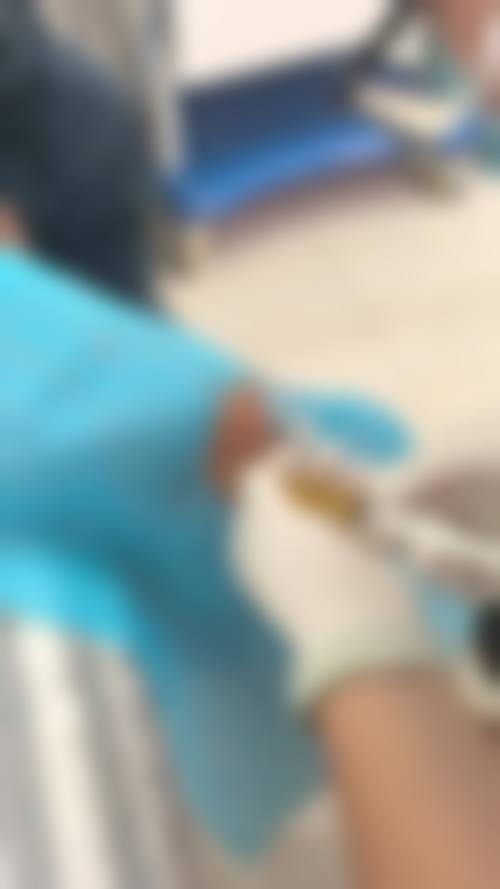 杨凡医生项目优势