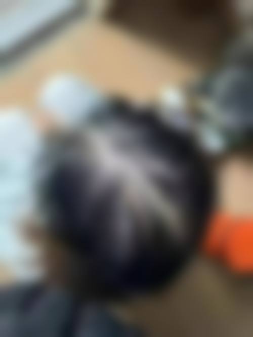 厦门碧莲盛植发医疗美容门诊部地址在哪里
