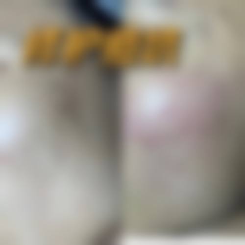 疤痕膏对手术疤痕有用吗——北京天坛医院