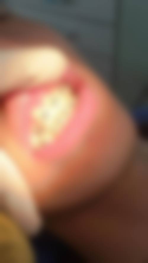 临床实例分享
