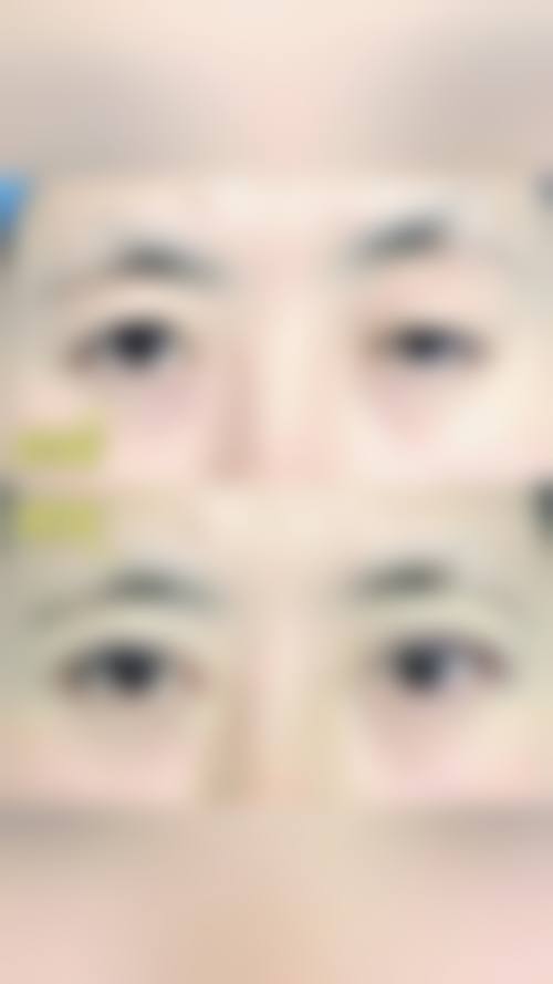 结语：选择正规眼科，守护清晰视界