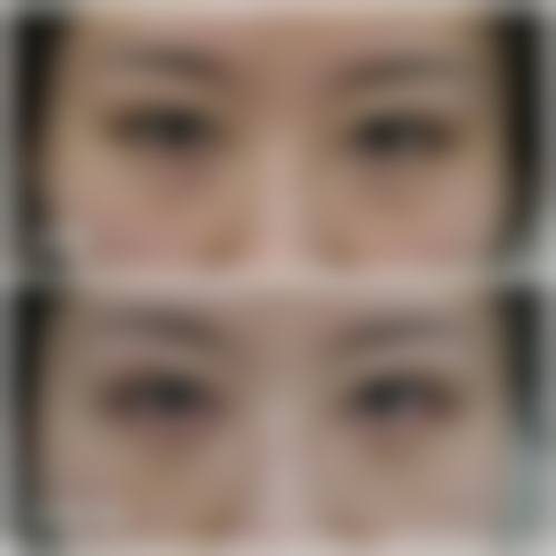 总结与预约号召