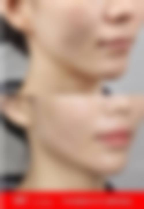 特色科室与项目:个性化定制,聚焦抗衰与眼部整形