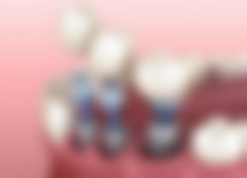 郑州泰安口腔门诊部擅长哪些项目?技术优势有哪些?