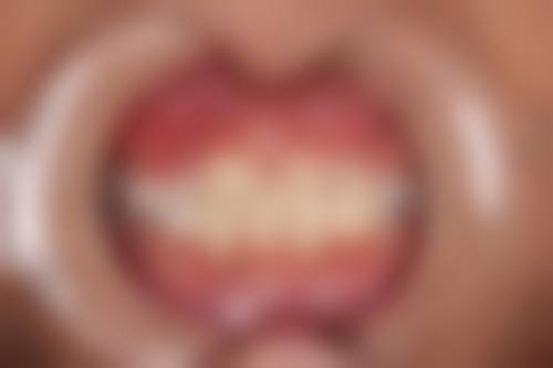 在郑州泰安口腔门诊部看牙,患者怎么说?