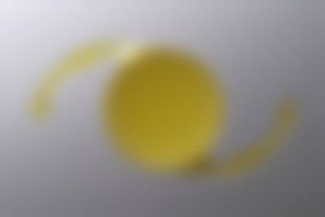 诊疗特色总结 蔡如远 盐城市第三人民医院眼科