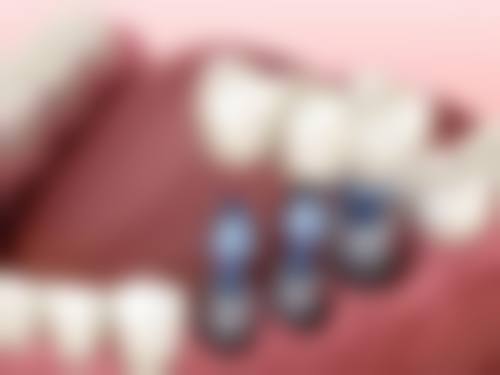 结束语