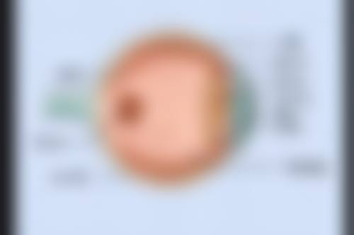 北京嘉悦眼科医院的技术优势有哪些？