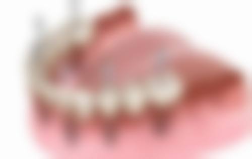 预约优惠活动