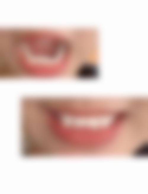 患者在呼和浩特至美口腔找刘佳丽医生的真实口碑如何?