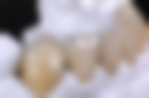FAQ(常见问题解答)
