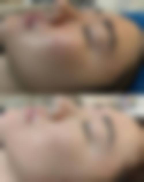 长沙念初整形医院价格表