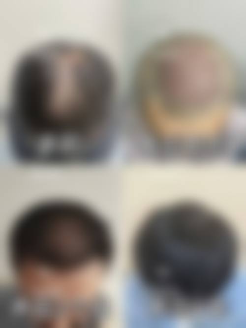 优惠活动详情与常见问题