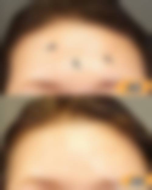 临床实例分享
