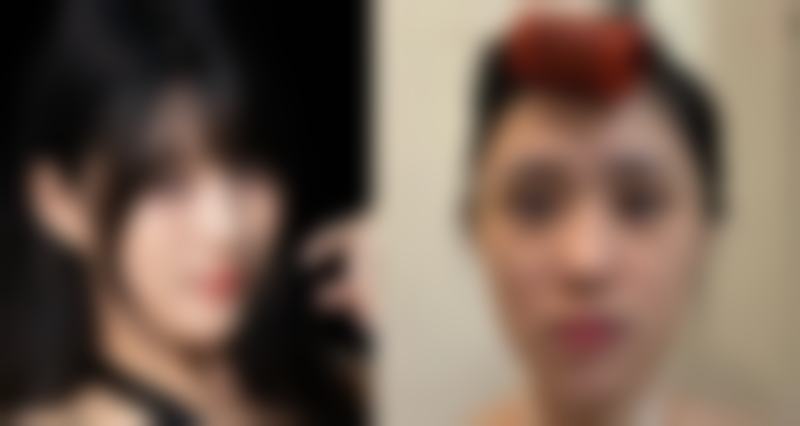 为何一只单眼皮一只双眼皮——合肥市第一人民医院